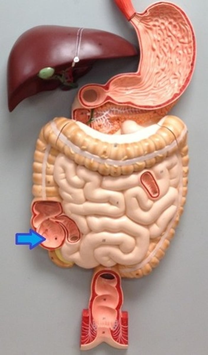 <p>The first part of the large intestine, connecting to the ileum.</p>