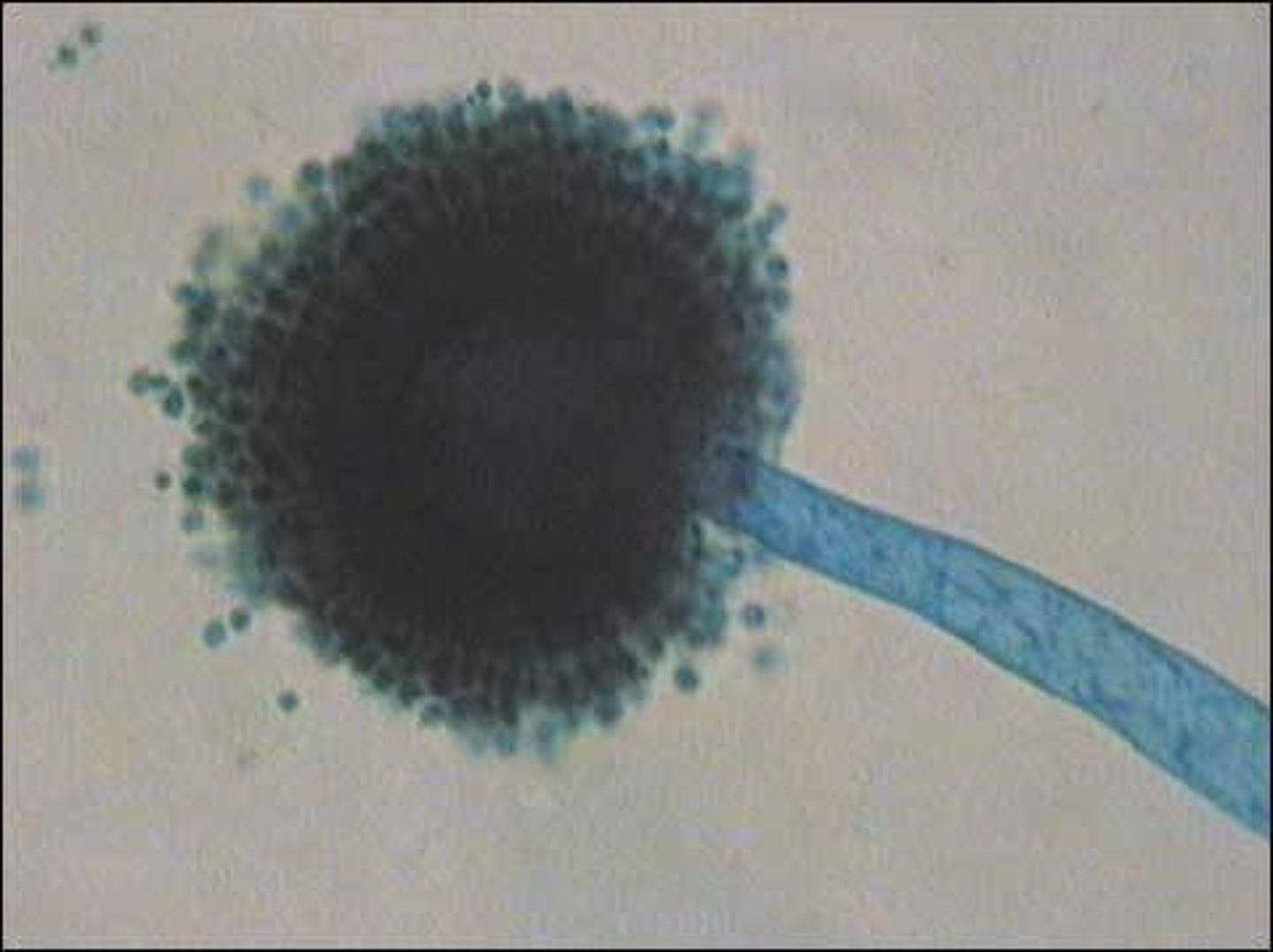 <p>Aspergillus niger microscopic</p>