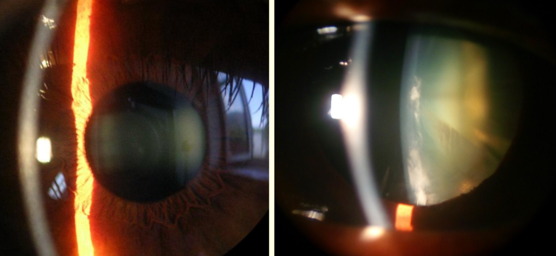 <p>What method is used for this?</p>