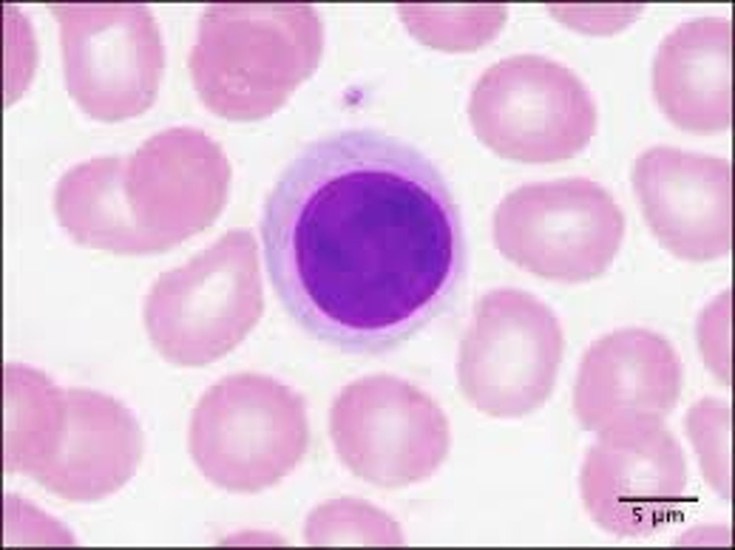 <p>Hvis en B celle modtager nok aktiveringssignaler, så kan den udvikle sig til en plasmacelle, som kan secernere frie antistof molekyler.</p><p>De har mere cytoplasma og kerneforhold end en hvilende B celle.</p>