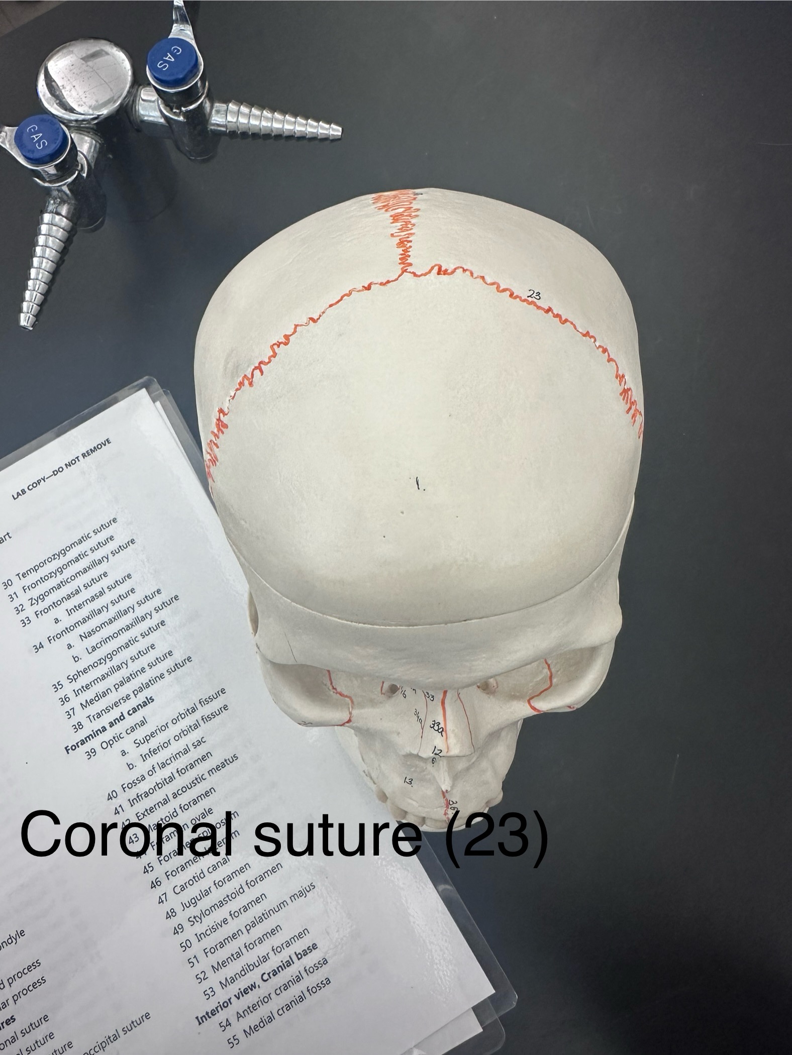 <p>Coronal Suture</p>
