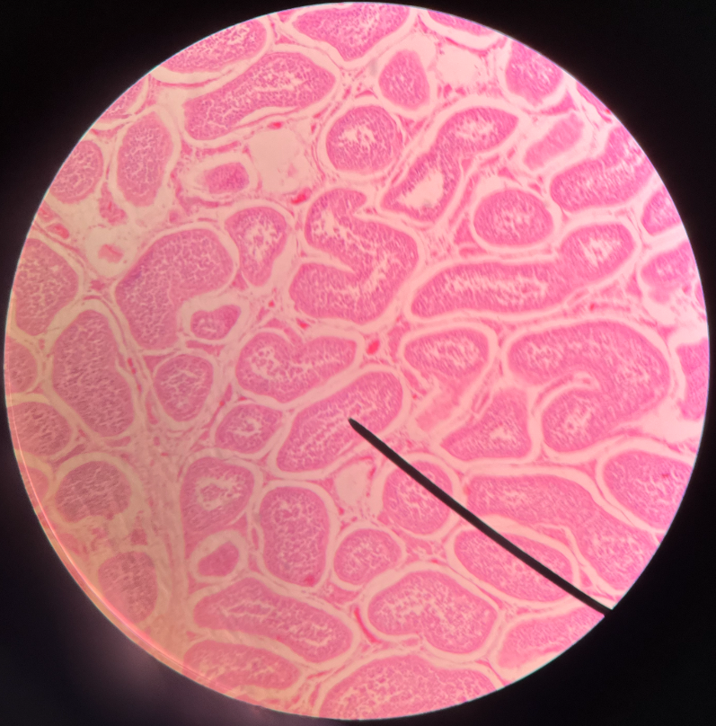 • Basic unit of the testes.

• Produces sperm.