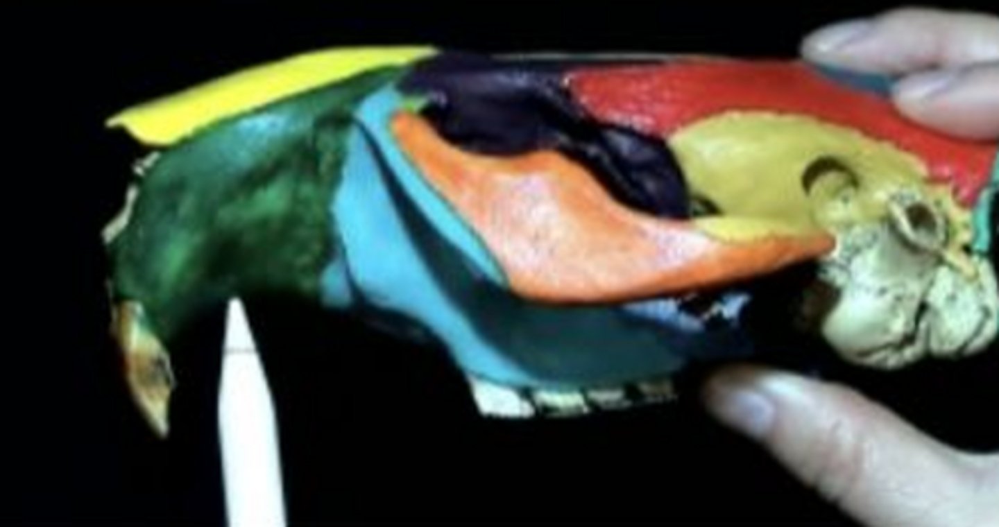 <p>Gap between teeth</p>