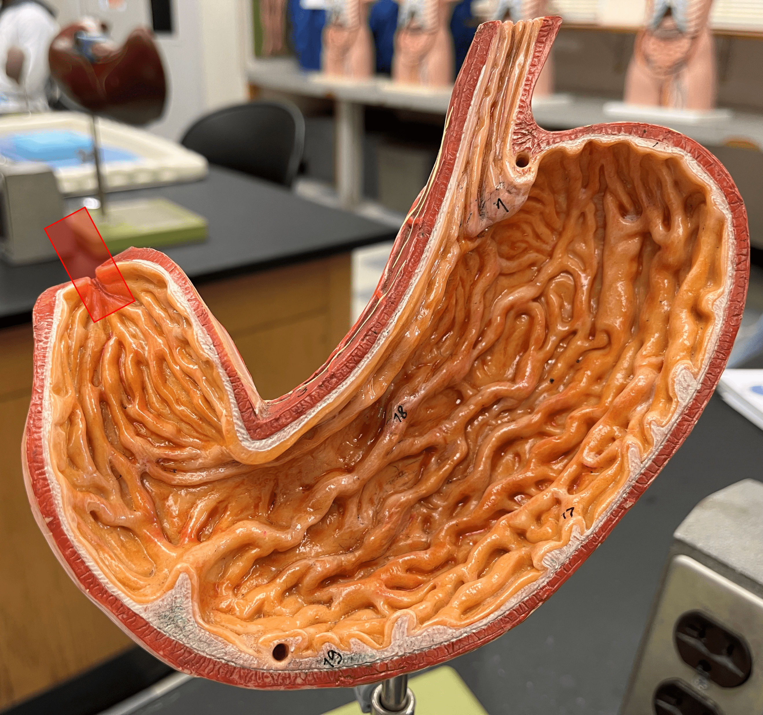 • Part of the pylorus of the stomach.

• The opening between the stomach and the duodenum.