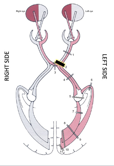 term image