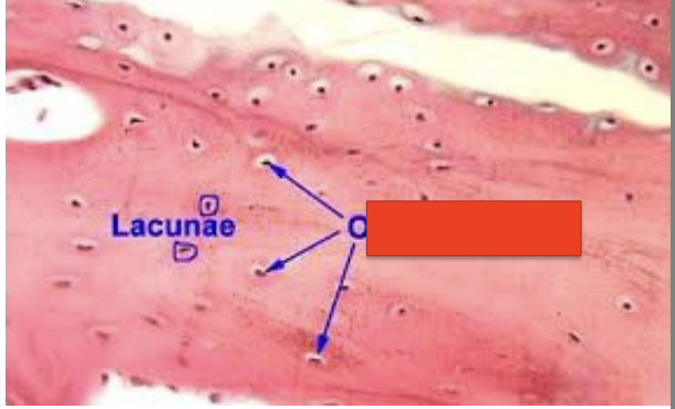<p>what is the red box (bone cell)?</p>