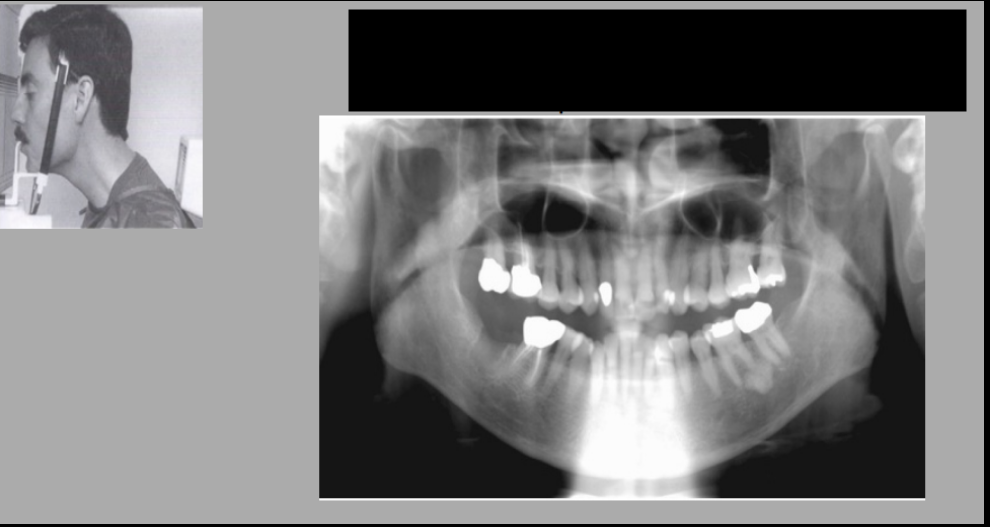 <p>What error is this?</p>