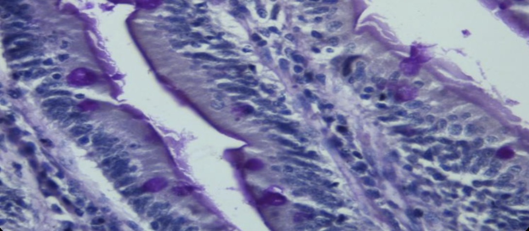 <p>Células epiteliales glnadulares caliciformes tinción de pas </p>