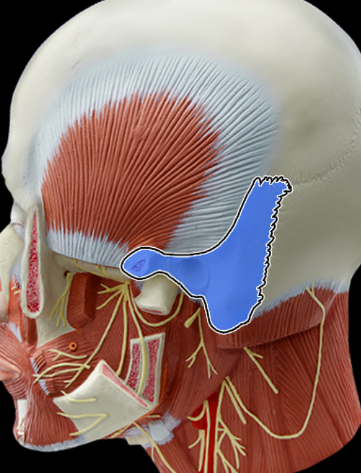 <p>Temporal bone</p>