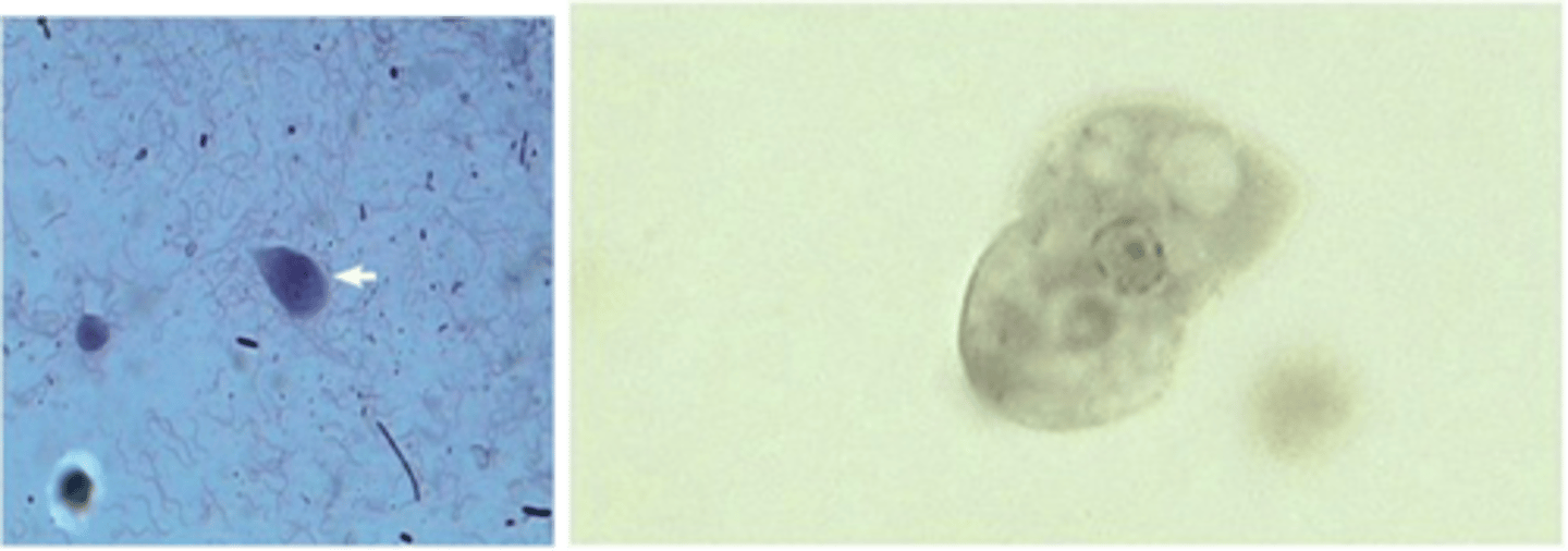 <p>These trophozoite protozoans would typically be found in:</p>