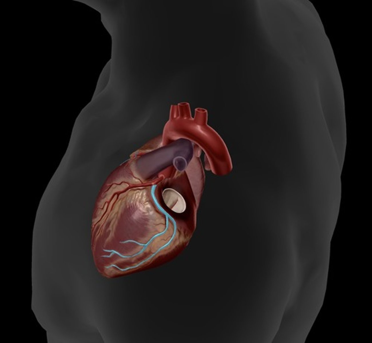<p>supplies the left atrium and the posterior walls of the left ventricle (left atrium dissected to visualize the entire artery)</p>