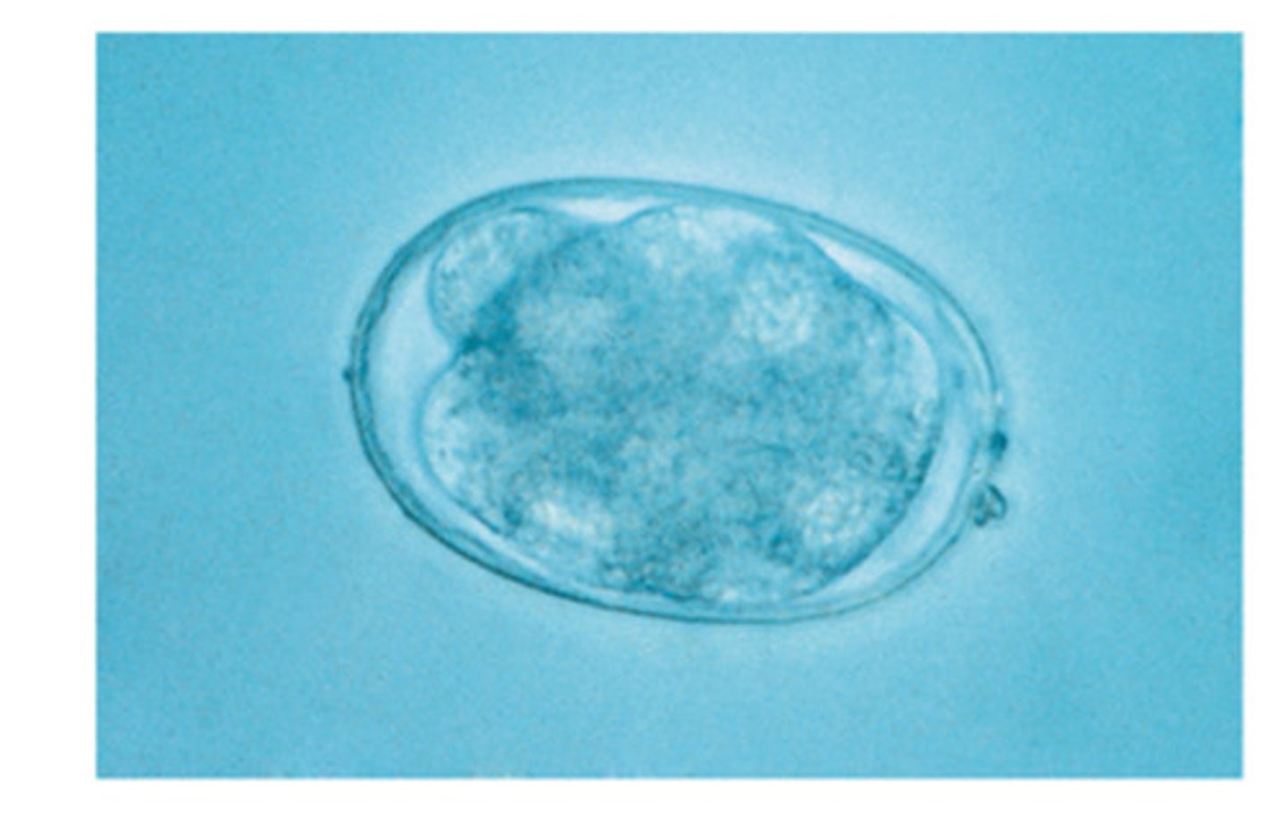 <p>This 8-16 cell moral ova of a nematode can be seen most commonly in a canine feces although there are species that infect feline. This nematode is__</p>