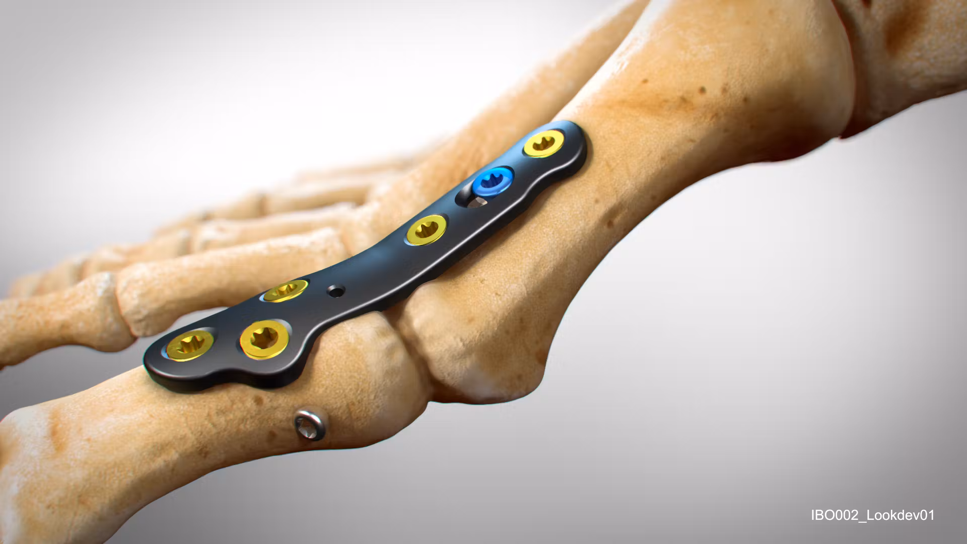 <p>Bone pins / plates</p>