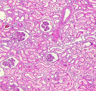 <p>Túbulo proximal</p><p>Constituït per un EPITELI MONOESTRATIFICAT CÚBIC amb un ribet en “raspall” format per MICROVILLOSITATS altes en sentit luminal.</p><p></p><p>Segmento más largo de la nefrona</p><p>Es la continuación de la cápsula de Bowman</p><p>Partes:</p><ul><li><p>Parte “contorneada” (túbulo contorneado proximal)</p></li></ul><ul><li><p>Parte recta (túbulo recto)</p></li></ul><p>Función:</p><ul><li><p>Reabsorció activa de diversos components (75%) del filtrat glomerular (aigua, glucosa i aminoàcids) per la via de la bomba sodi/potasi/ATPasa o bé per endocitosis.</p></li></ul><p>Nuclis rodons. </p><p>Citoplasma amb abundants organeles, especialment MITOCONDRIES, que proporcionen la energia per al transport actiu de diversos components de la orina.</p><p></p>