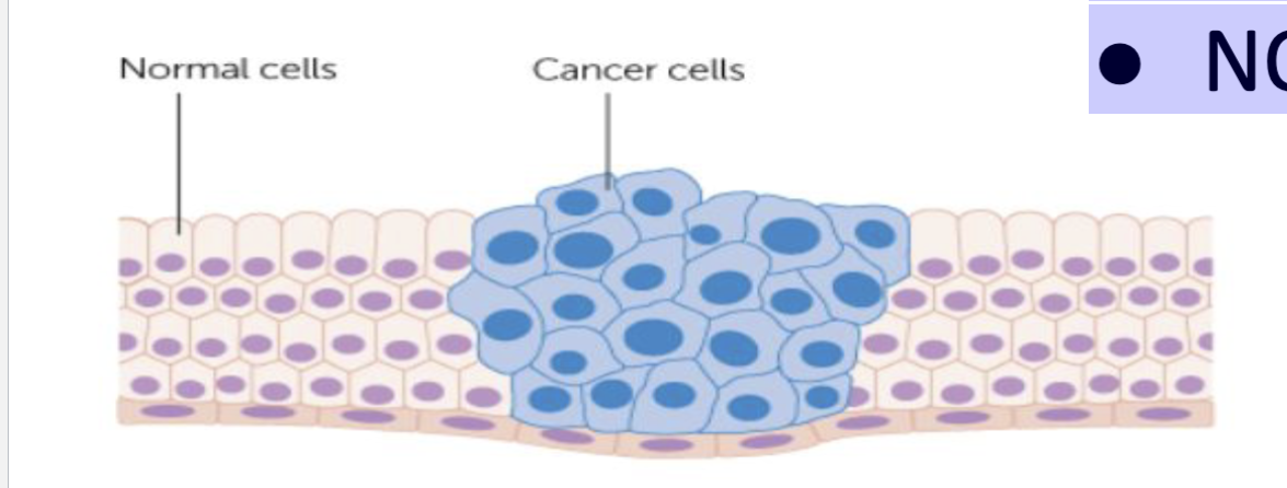 <p>unregulated cell growth</p><p><span style="color: #fdfafa">● Escapes checkpoints</span><span style="color: #fdfafa"><br></span><span style="color: #fdfafa">● Divides rapidly</span><span style="color: #fdfafa"><br></span><span style="color: #fdfafa">● NOT density dependent</span></p>