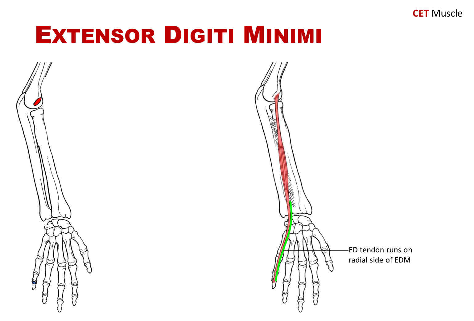 <p>Insertion of Extensor Digiti Minimi</p>