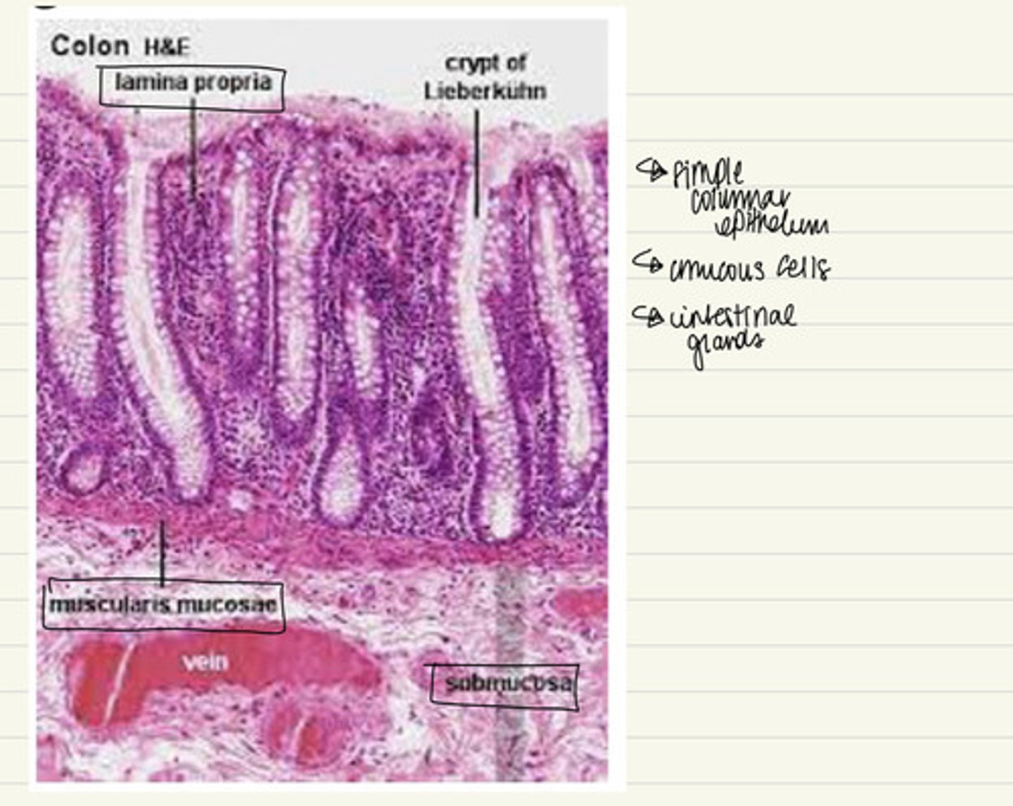 <p>i. Mucosa 1. Simple columnar epithelium 2. Mucous cells 3. Intestinal glands 4. Lamina propria 5. Muscularis mucosae</p><p>ii. Submucosa</p><p>iii. Muscularis externa</p><p>iv. Serosa</p>