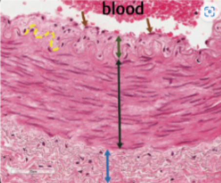 <p>what is this (black arrow) </p>