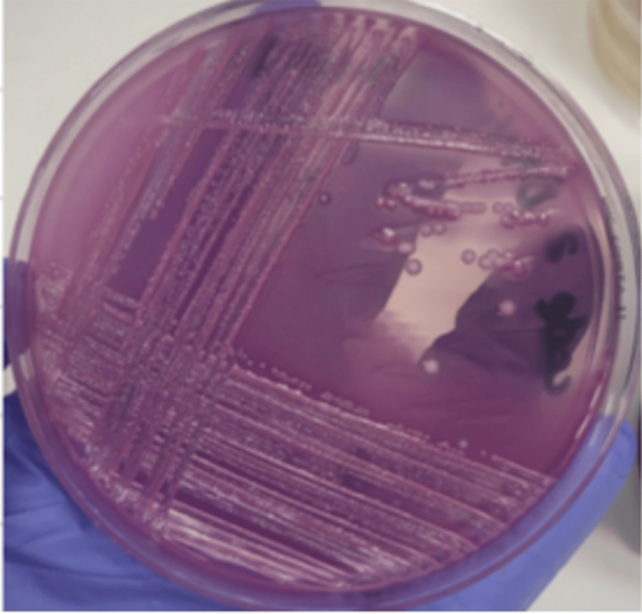 <p>which enterobacteria produces these colonies on macconkey agar?</p>