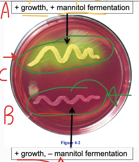<p>Mannitol Salt Agar test A-H Reaction </p>