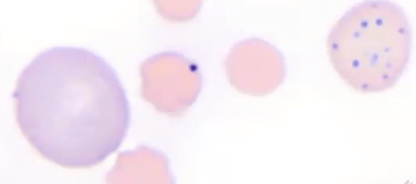 <p>- Aggregated RNS that stains with Wright's stain. Most common in ruminants, rare in health and increase with regeneration.</p>