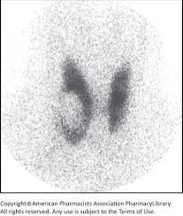 is this nodule hot or cold?