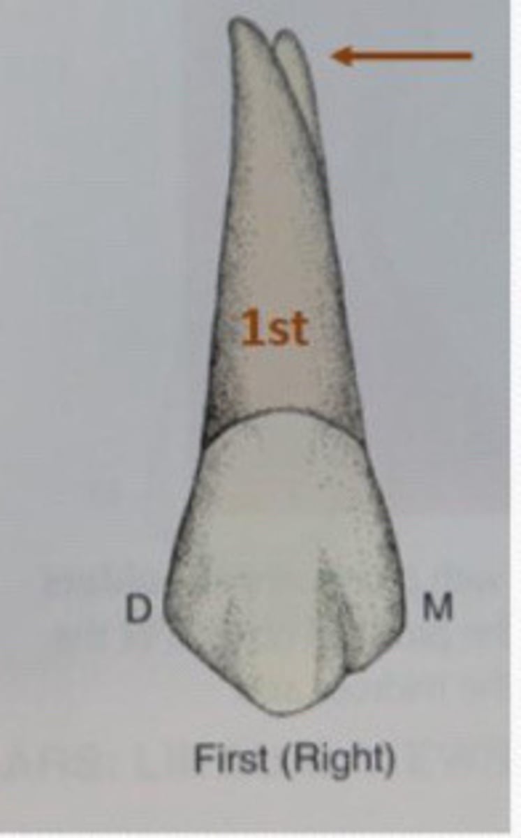 <p>Can occasionally see the __ root tip from buccal</p><p>on first premolars</p>