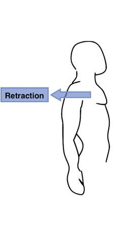 <p>retraction</p>