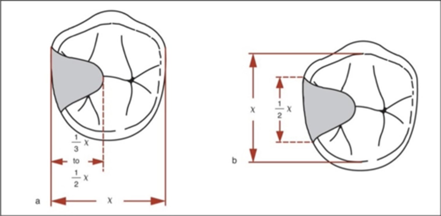 <p>note: an extended occlusal rest is helpful when a molar abutment is mesially tipped, to enhance force down the long axis of the tooth (vs a more distally-directed force with a shorter mesial occlusal rest). If &lt;1mm, the rest will break off!</p>
