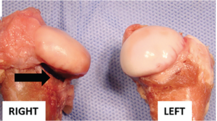 <p><span style="background-color: transparent;">Left and right femoral heads of a piglet. </span></p><p><span style="background-color: transparent;">Where and what is the lesion?</span></p>