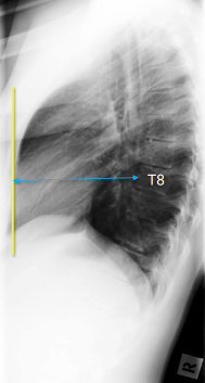 <p>Q what is the name of this measurement? and what is the average + range?</p>