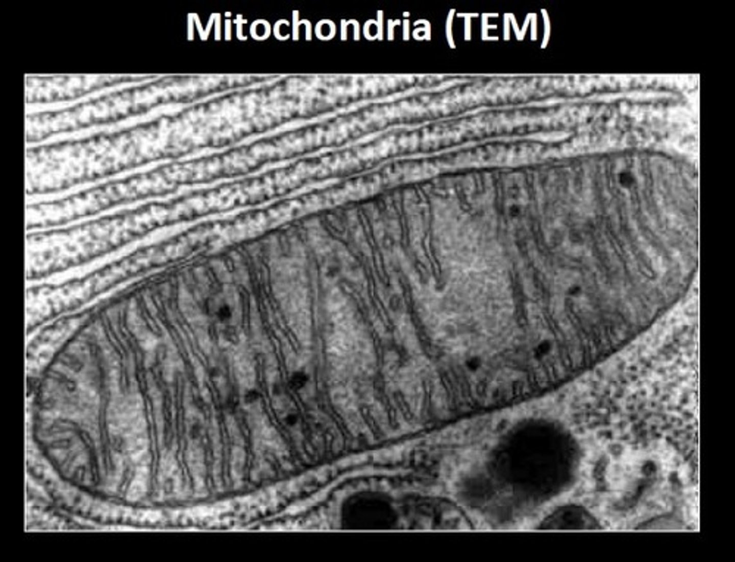 <p>an electron microscope that produces two-dimensional images.</p>