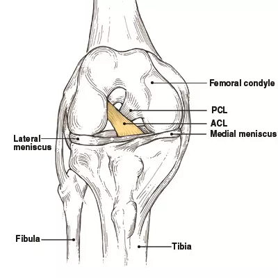 <p>B) Anterior cruciate ligament</p>