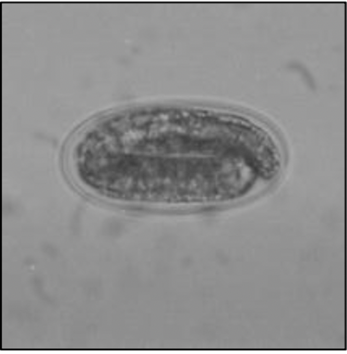 <p>What egg does this parasite belong to? The egg is 80-100 microns</p>