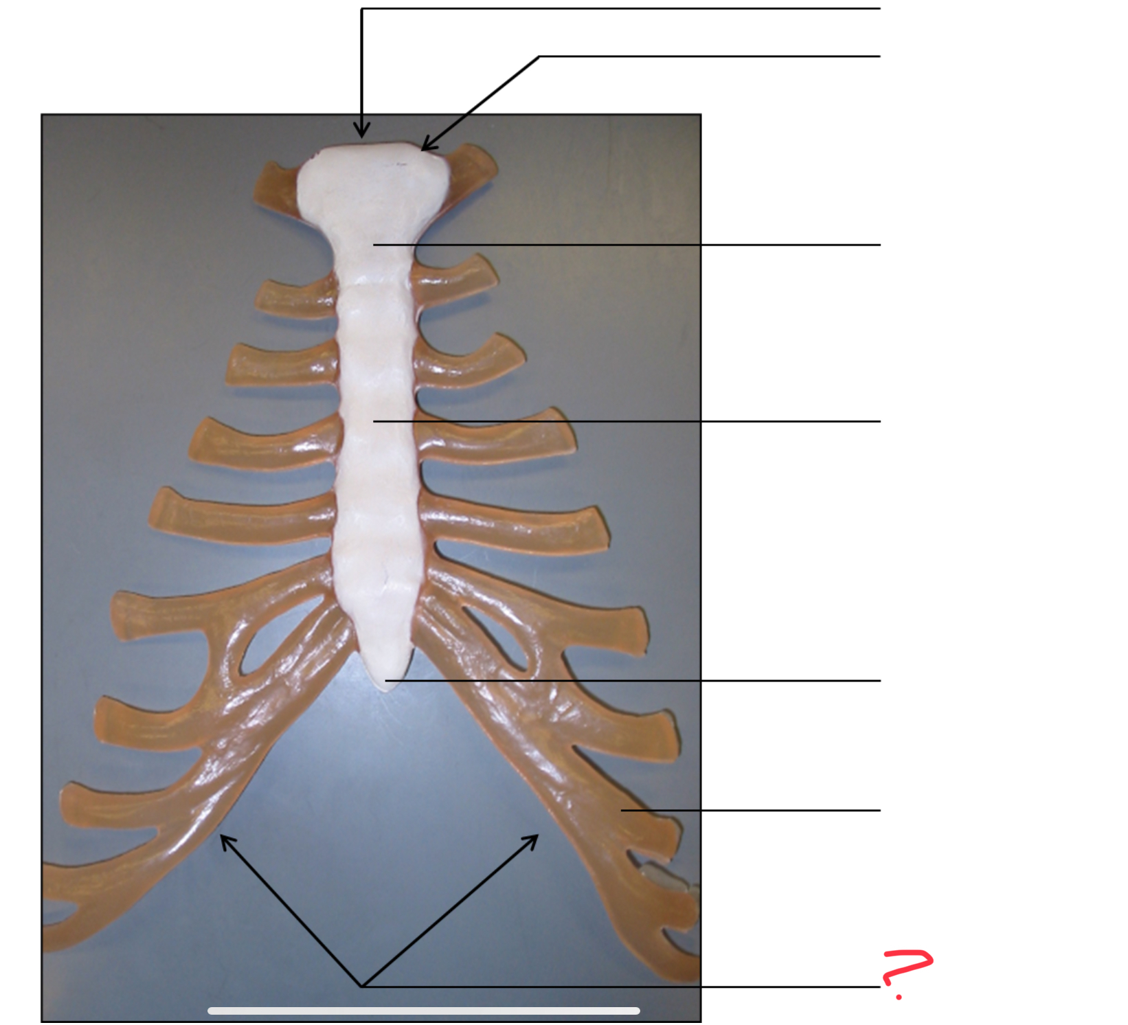 <p>costal margins</p>