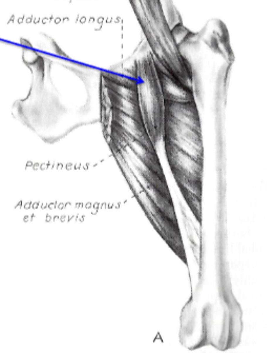 <p>Insertion of pectineus:</p>