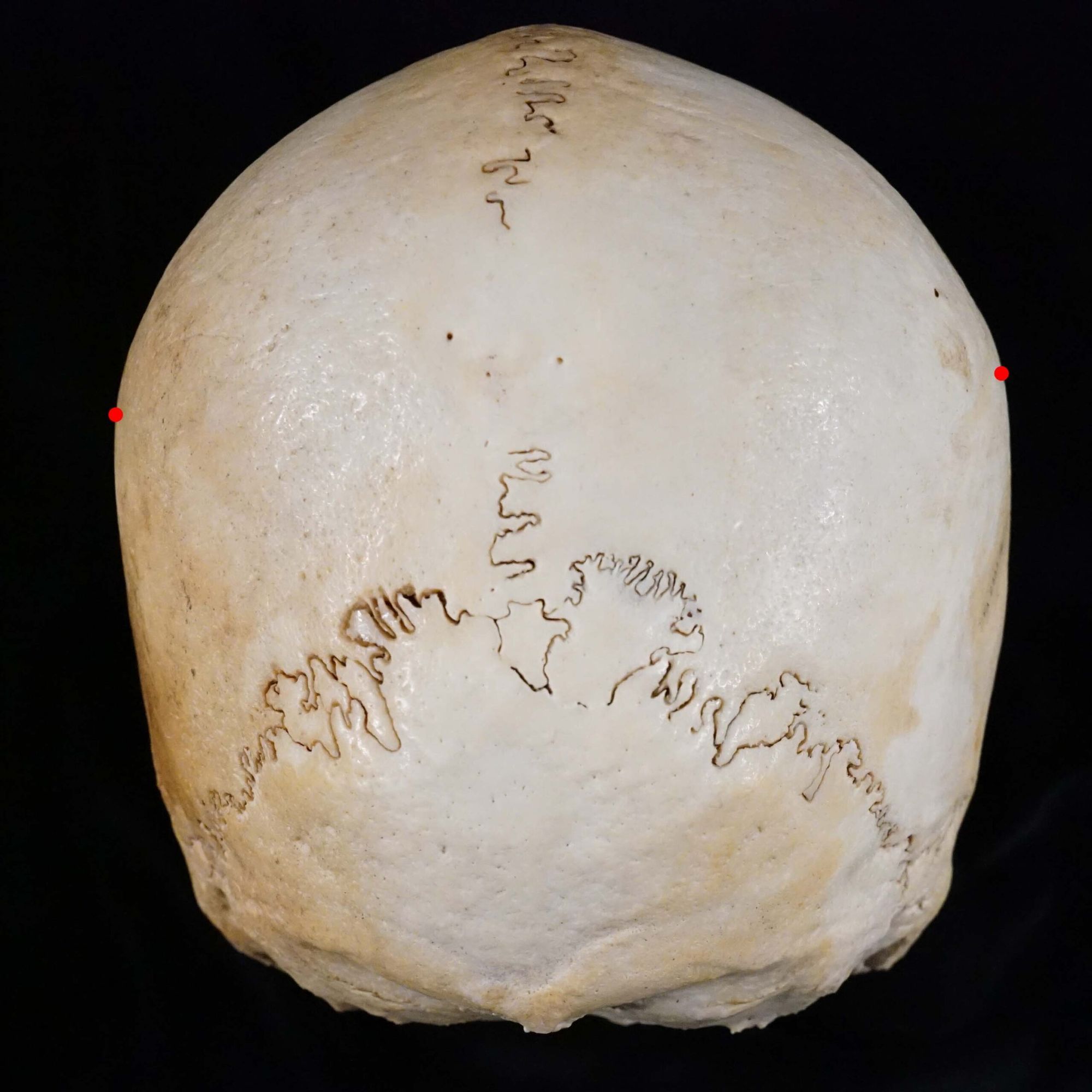 <p>Point of greatest cranial breadth</p>