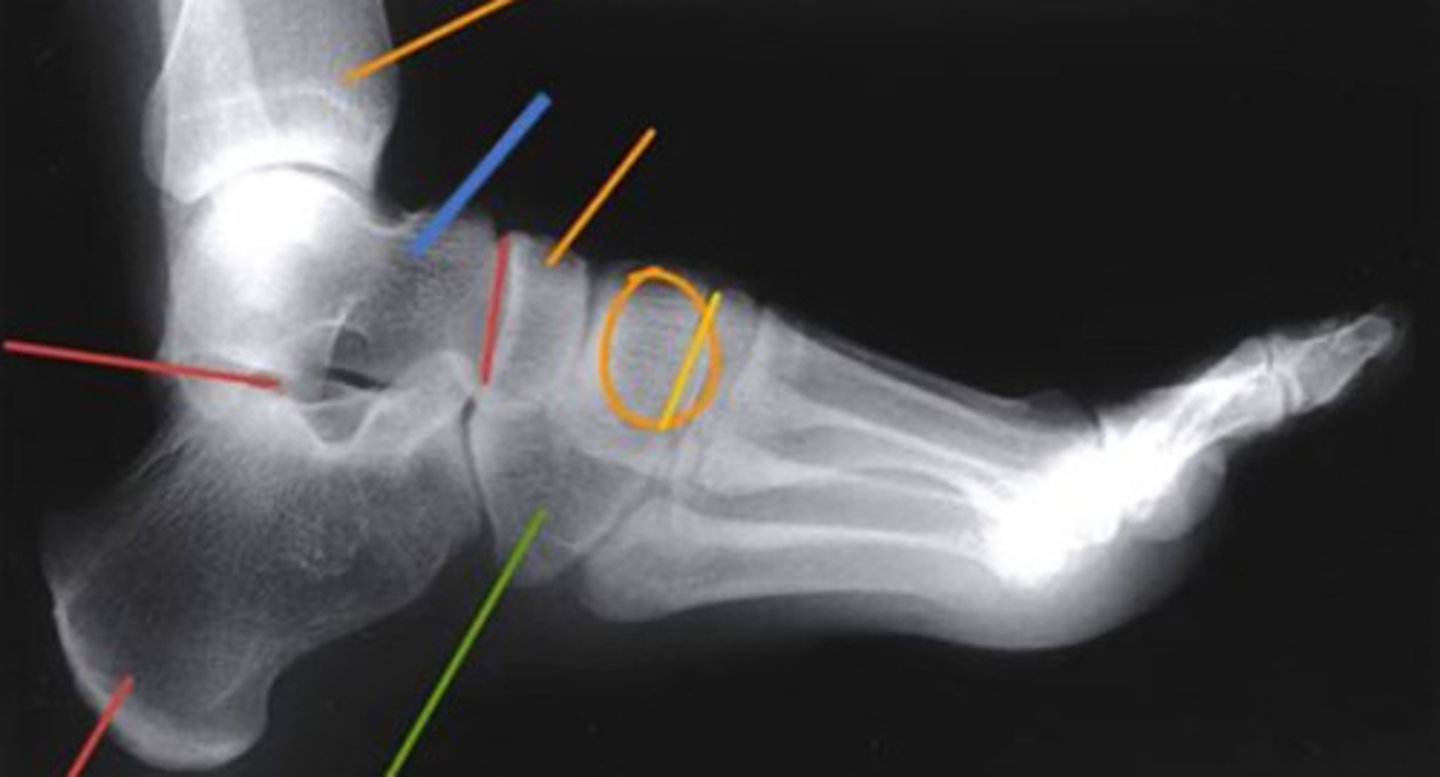 <p>talus</p><p>3 multiple choice options</p>