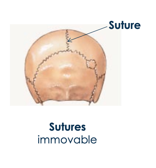 <p>skull joints </p>
