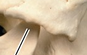 <p>What is the name of this bone in the skull?</p>