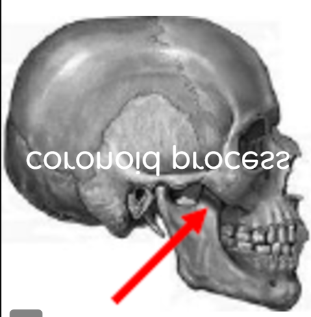term image