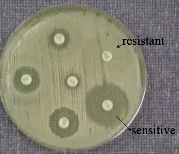 <p><strong><u>Name of method:</u></strong>&nbsp;<strong>Kirby-Bauer Method</strong></p><p><strong><u>Principal:</u></strong></p><ul><li><p>Paper discs containing known concentrations of antibiotics are placed on the surface of an agar plate (usually <strong>Mueller–Hinton agar</strong>) that has been inoculated evenly with the test bacteria.</p></li><li><p>The antibiotic diffuses outward from the disc into the agar.</p></li><li><p>After incubation, bacteria grow everywhere <strong>except</strong> where the antibiotic concentration is high enough to inhibit them.</p></li><li><p>This clear area around each disc is called the <strong>zone of inhibition</strong>.</p></li></ul><p><strong><u>Interpretation:</u></strong></p><ul><li><p>Measure the <strong>diameter</strong> of the inhibition zone (in mm).</p></li><li><p>Compare with standard reference charts (CLSI or EUCAST) to classify the bacterium as:</p><ul><li><p><strong>Sensitive (S)</strong></p></li><li><p><strong>Intermediate (I)</strong></p></li><li><p><strong>Resistant (R)</strong></p></li></ul></li></ul><p></p>
