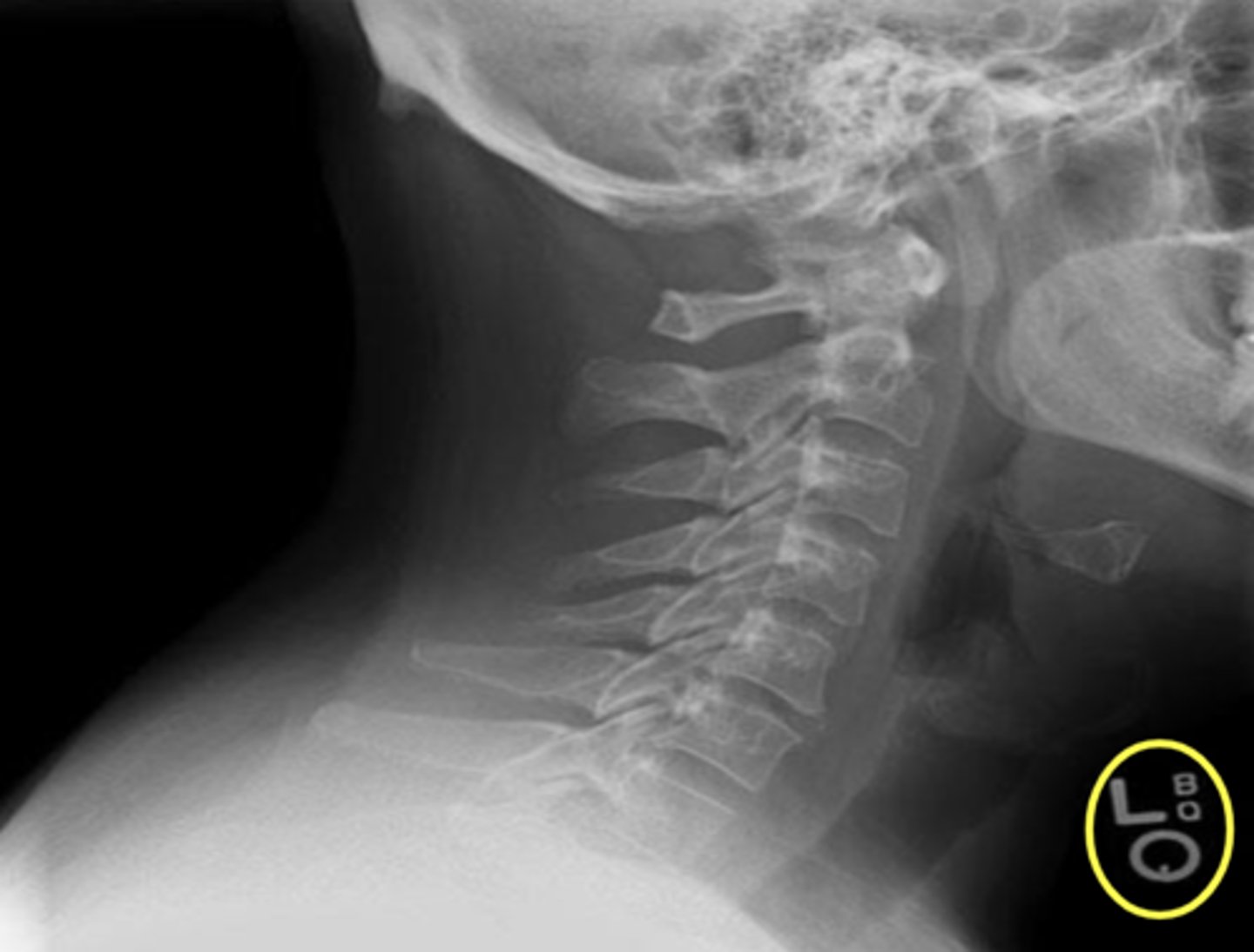 <p>What is outlined in yellow?</p>