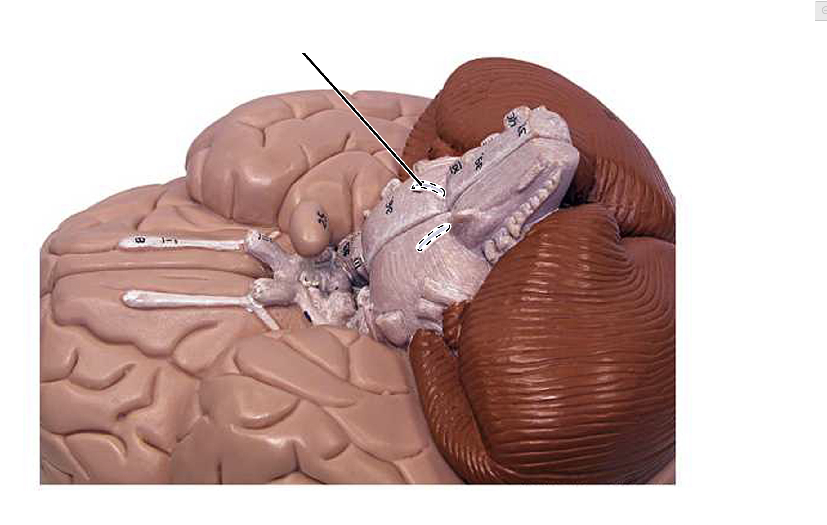 term image