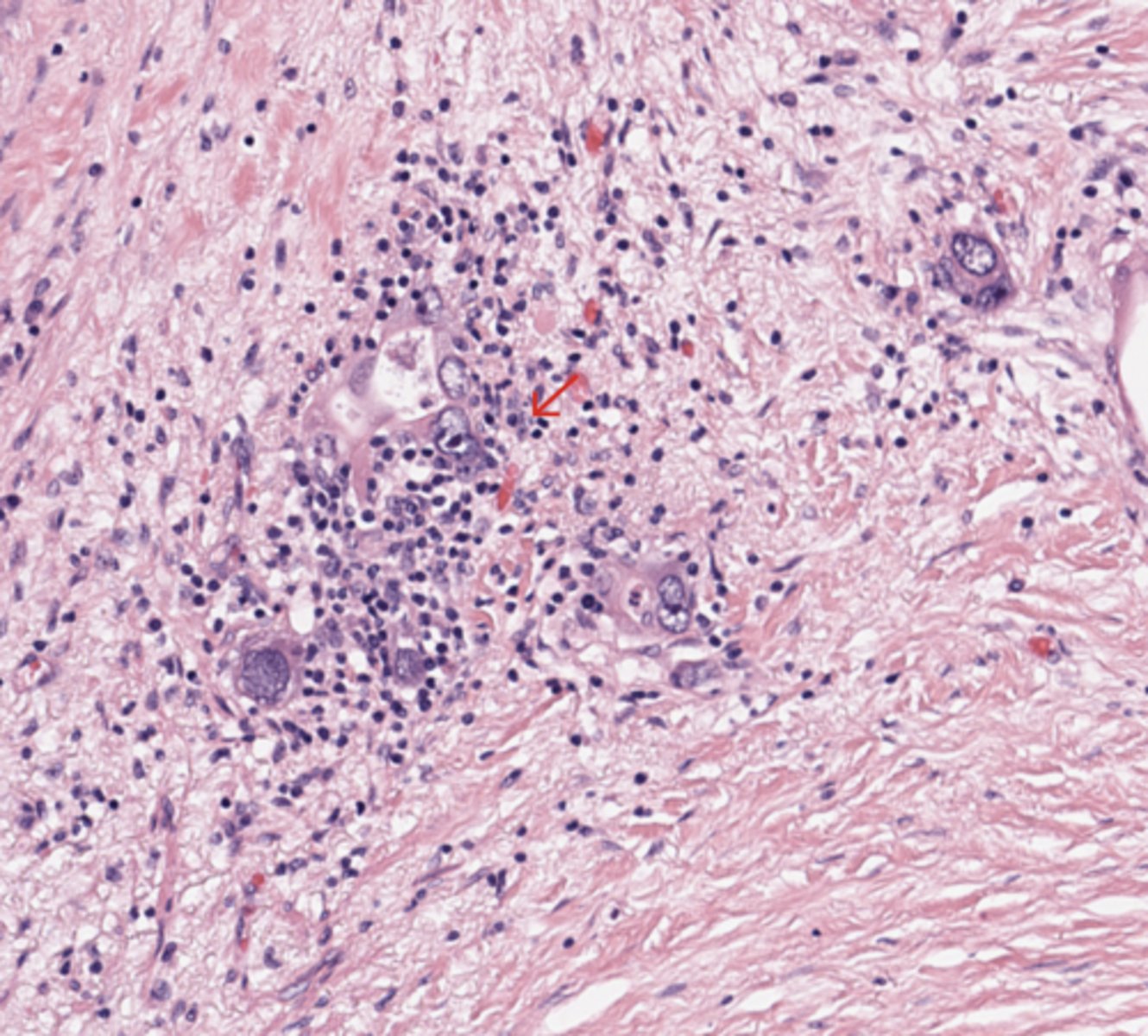 <p>Pancreas</p>