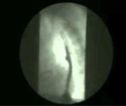 <p>What is this and what type of scan </p>