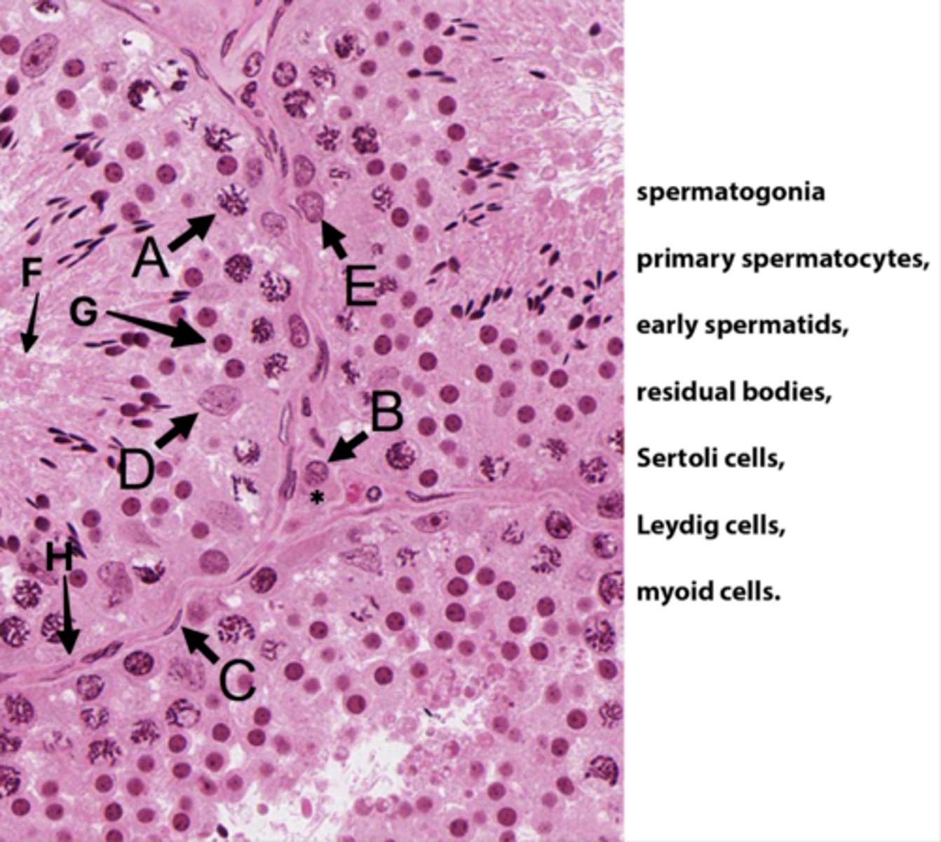 <p>Which letter indicates the cells that produce androgen binding protein/SHBG?</p>