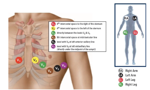 V1 - V2 - V4 - V3 - V5 - V6
