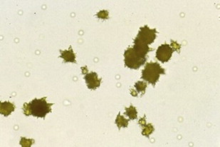 <p>Form in alkaline pH</p><p>Presence may be significant if formed in-vivo (dehydration)</p>