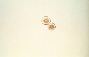 <p>Identify the urine sediment element shown:</p>